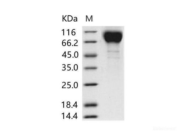 HIV-1 gp120 Recombinant Protein (group M, subtype CRF07_BC) (His Tag)