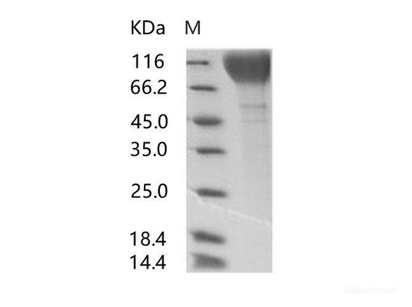HIV-1 gp120 Recombinant Protein (group P, strain RBF168) (His Tag)