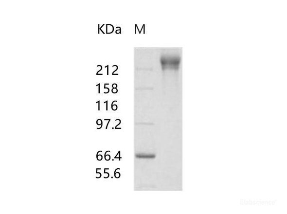 HIV-1 gp140 Recombinant Protein (group M, subtype CRF07_BC) (Fc Tag)