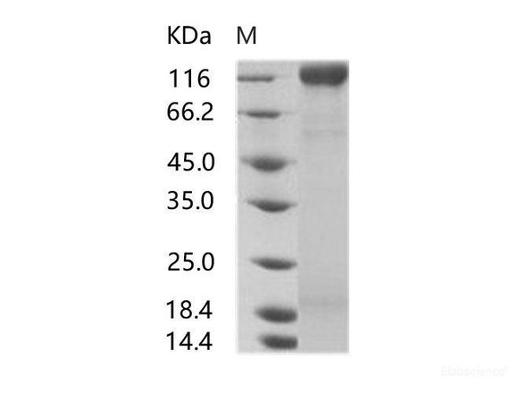 HIV-1 gp160 Recombinant Protein (gp120 subunit) (group N, strain 06CM-U14296) (His Tag)