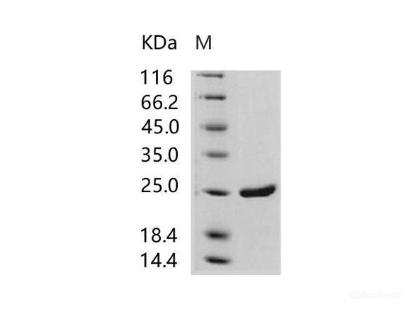 HIV-1 p24 Recombinant Protein (group M, subtype B, strain 92418) (His Tag)