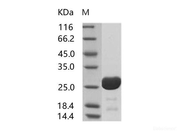 HIV-1 p24 Recombinant Protein (group O, strain BCF06) (His Tag)