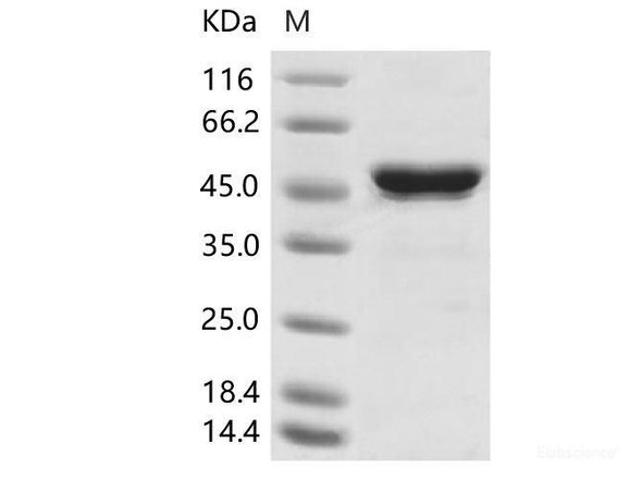 Human coronavirus (HCoV-HKU1) NucleoRecombinant Protein / NP Recombinant Protein (His Tag)