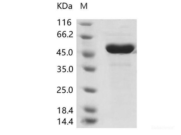 Human coronavirus (HCoV-OC43) NucleoRecombinant Protein / NP Recombinant Protein (His Tag)