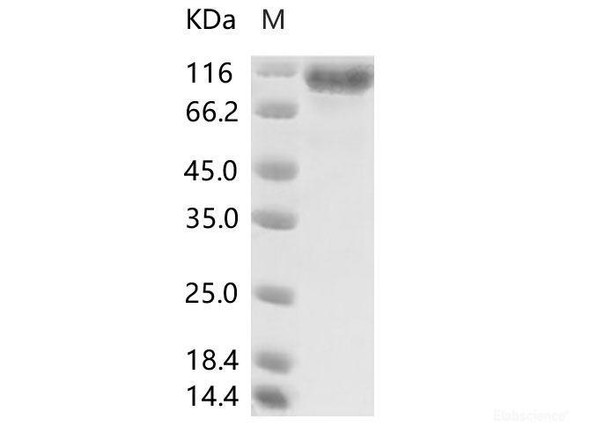 MERS-CoV Spike/S1 Recombinant Protein (S1 Subunit, aa 1-725, His Tag), HPLC-verified