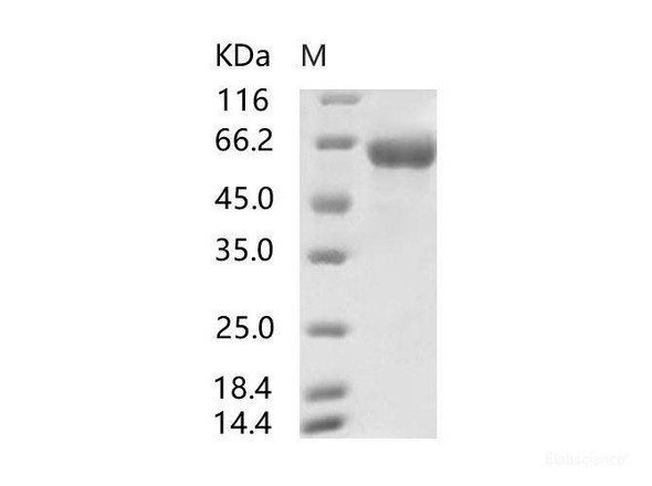 SARS-CoV Spike S2-His Recombinant Protein