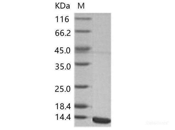 WNV (lineage 2, strain Nea Santa-Greece-2010) E / Envelope Recombinant Protein (Domain III, His Tag)