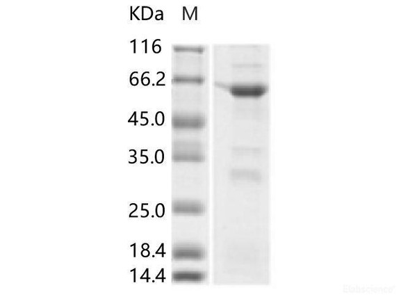 ZIKV E / Envelope Recombinant Protein (Domain I, His & MBP Tag)