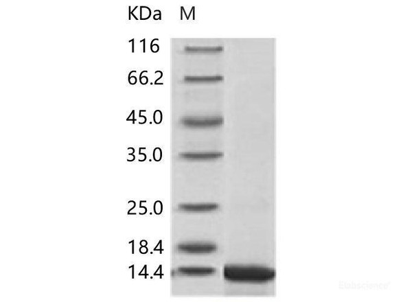 ZIKV E / Envelope Recombinant Protein (Domain III, His Tag)