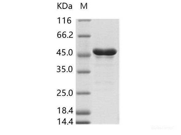 ZIKV (strain Zika SPH2015) Envelope Recombinant Protein (aa 291-696, His Tag)