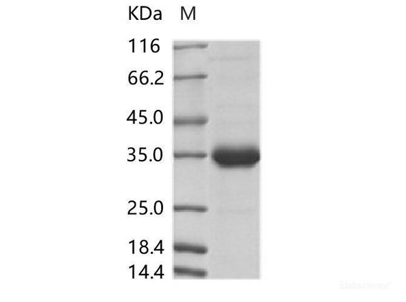 ZIKV (strain Zika SPH2015) Membrane Recombinant Protein (Fc Tag)