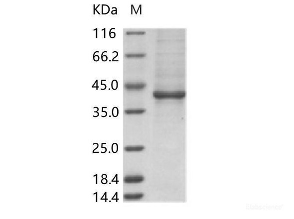 ZIKV (strain Zika SPH2015) Envelope Recombinant Protein (Domain III, Fc Tag)
