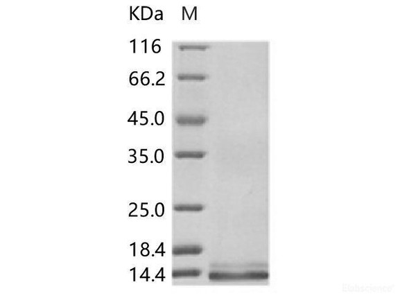 ZIKV (strain Zika SPH2015) Envelope Recombinant Protein (Domain III, His Tag)