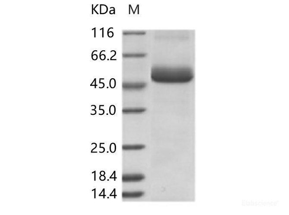 ZIKV (strain Zika SPH2015) NS1 Recombinant Protein (N-His Tag)
