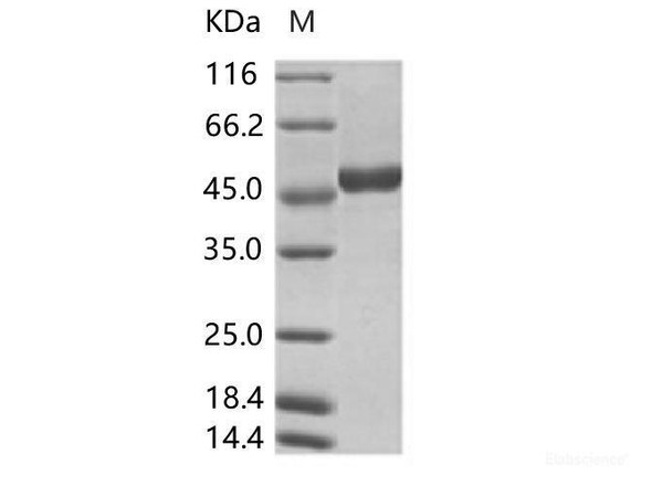 ZIKV (strain Zika SPH2015) NS1 Recombinant Protein (C-His Tag)