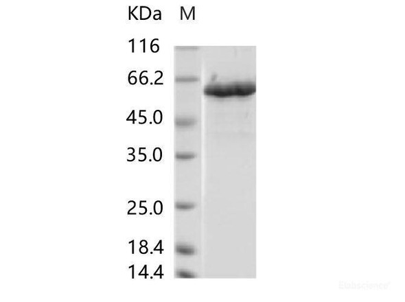 ZIKV (strain Zika SPH2015) NS5 Recombinant Protein (His Tag)