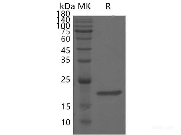 SARS-CoV-2 ORF3b Recombinant Protein