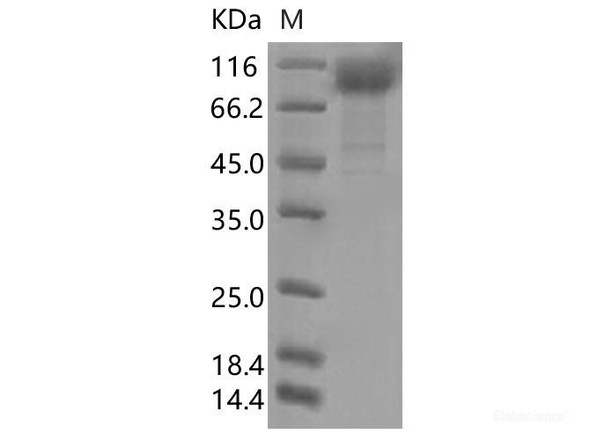 Recombinant SARS-CoV-2 Spike S1(W152C, L452R, D614G) (His Tag)