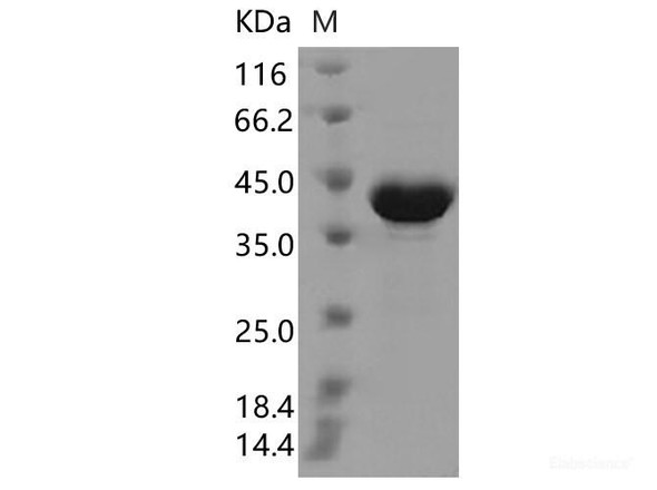 SARS-CoV-2 N Recombinant Protein (T205I) (His Tag)