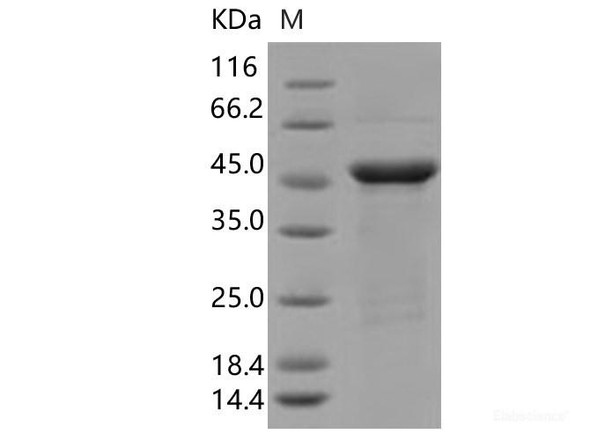 SARS-CoV-2 N Recombinant Protein (R203K, G204R) (His Tag)