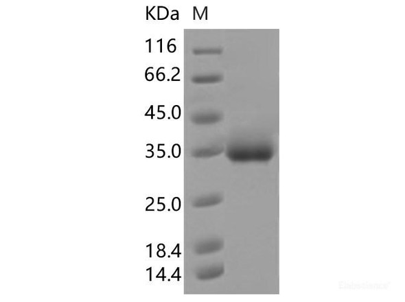 Recombinant SARS-CoV-2 Spike RBD (S494P) (His Tag)