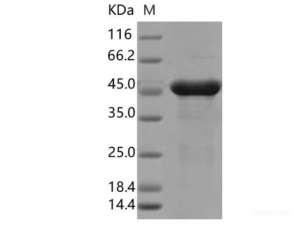 SARS-CoV-2 N Recombinant Protein (P13L) (His Tag)