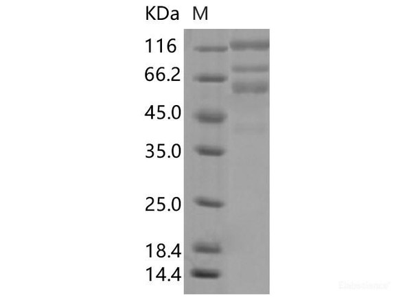 Recombinant SARS-CoV-2 Spike S1+S2 ECD (L18F,D80A,D215G,ΔLAL242-244,R246I,K417N,E484K,N501Y,D614G,A701V) (His Tag), Biotinylated