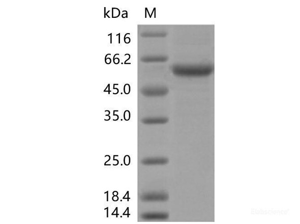 Recombinant SARS-CoV-2 Spike RBD (K417N, E484K, N501Y) (rFc Tag)