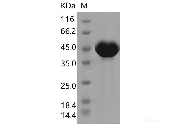 SARS-CoV-2 N Recombinant Protein (P80R) (His Tag)