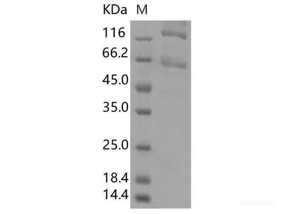 Recombinant SARS-CoV-2 Spike S1+S2 ECD (L18F, T20N, P26S, D138Y, R190S, K417T, E484K, N501Y, D614G, H655Y, T1027I, V1176F) (His Tag)