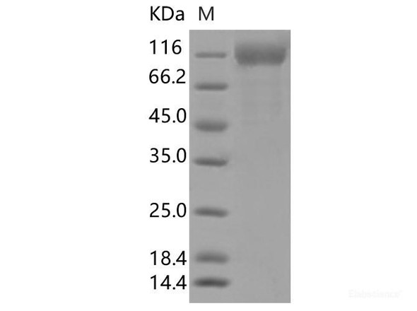 Recombinant SARS-CoV-2 Spike S1 (L18F, T20N, P26S, D138Y, R190S, K417T, E484K, N501Y, D614G, H655Y) (His Tag)