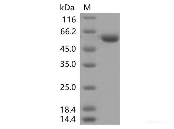 Recombinant SARS-CoV-2 Spike RBD (K417T, E484K, N501Y) (rFc Tag)