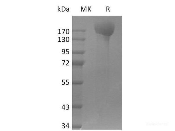 SARS-CoV-2 ΔFVI-S trimer Recombinant Protein (His Tag)