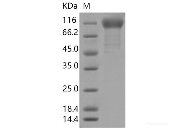 Recombinant SARS-CoV-2 Spike S1 (Q677H) (His Tag)