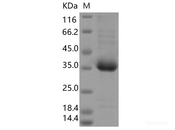 Recombinant SARS-CoV-2 Spike RBD (V503F) (His Tag)