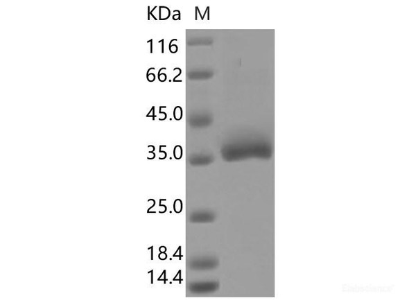 Recombinant SARS-CoV-2 Spike RBD (Q414E) (His Tag)