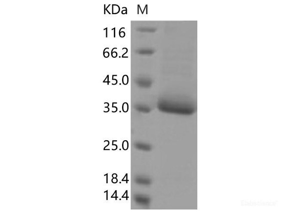 Recombinant SARS-CoV-2 Spike RBD (F377L) (His Tag)