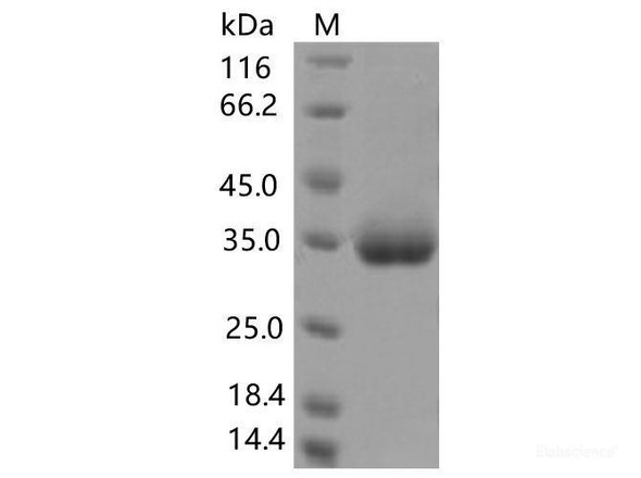 Recombinant SARS-CoV-2 Spike RBD (K378R) (His Tag)