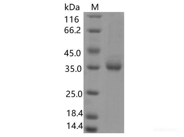 Recombinant SARS-CoV-2 Spike RBD (Q409E) (His Tag)