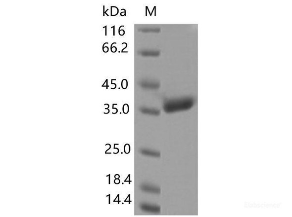 Recombinant SARS-CoV-2 Spike RBD (A344S) (His Tag)