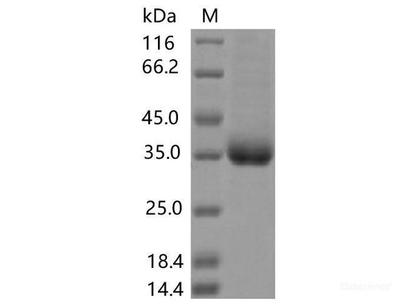 Recombinant SARS-CoV-2 Spike RBD (A520V) (His Tag)