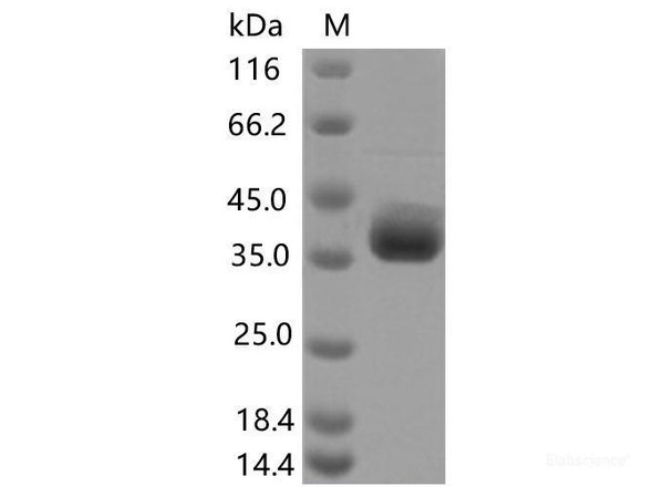 Recombinant SARS-CoV-2 Spike RBD (F490S) (His Tag)