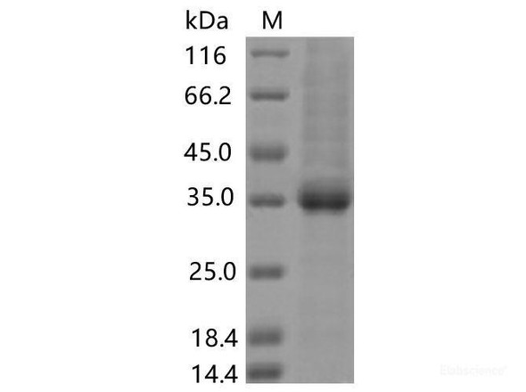 Recombinant SARS-CoV-2 Spike RBD (N370S) (His Tag)