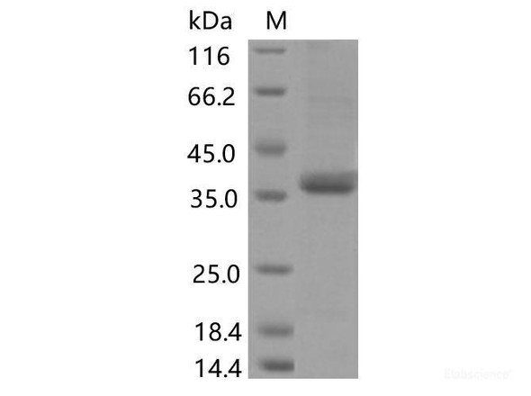 Recombinant SARS-CoV-2 Spike RBD (G482S) (His Tag)