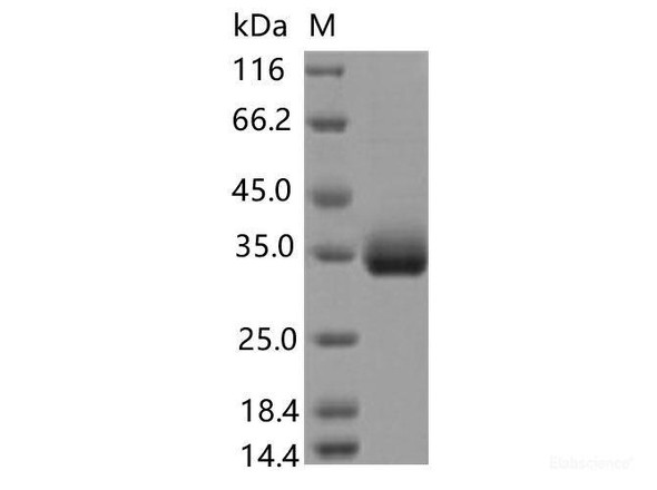 Recombinant SARS-CoV-2 Spike RBD (E471Q) (His Tag)