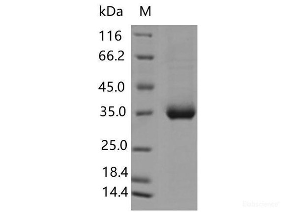 Recombinant SARS-CoV-2 Spike RBD (L455F) (His Tag)