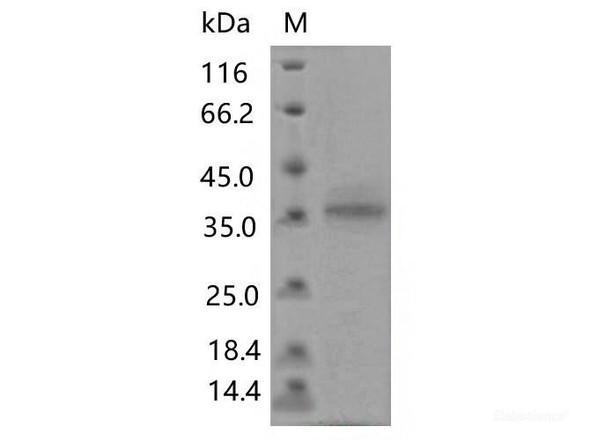 Recombinant SARS-CoV-2 Spike RBD (F456L) (His Tag)