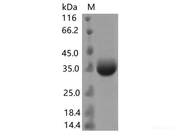 Recombinant SARS-CoV-2 Spike RBD (G446S) (His Tag)