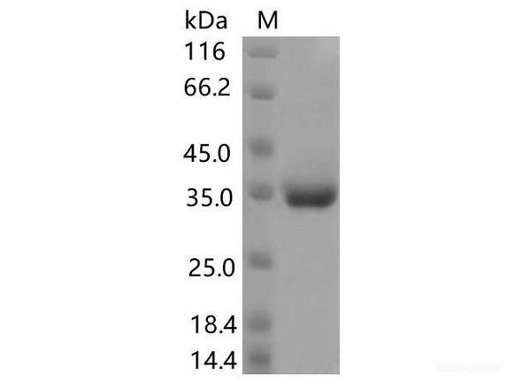 Recombinant SARS-CoV-2 Spike RBD (P499R) (His Tag)