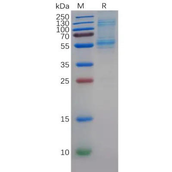 Human DLL3 Protein, His Tag (HDPT0493)